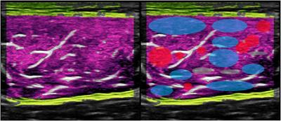 A novel ultrasound approach in assessing IMAT in critically ill patients